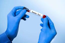 Gli esami del sangue vanno a ricercare i livelli di emocromo nel sangue