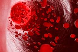L'anemia è una malattia del sangue caratterizzata da valori bassi di emoglobina