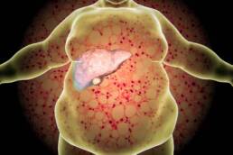 L’aumento delle tossine nel fegato può far ingrassare
