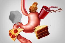 Un'alimentazione poco salutare può essere una delle cause dello stomaco gonfio